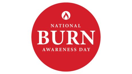 Burn day