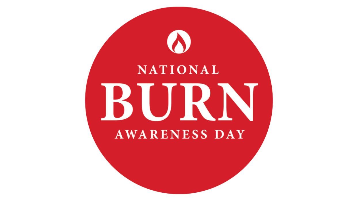 Burn day