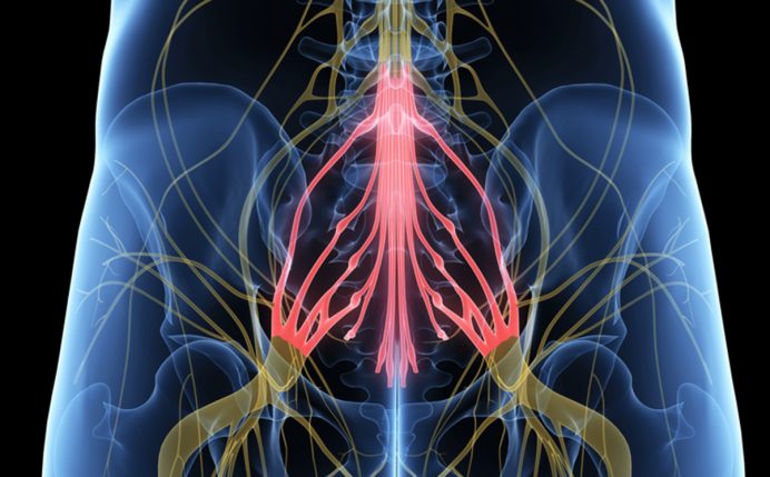 Cauda Equina Syndrome