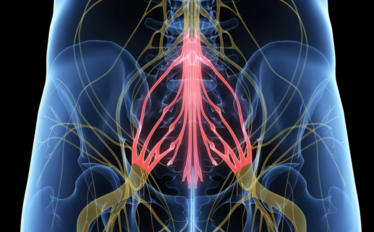 Cauda Equina Syndrome Symptoms