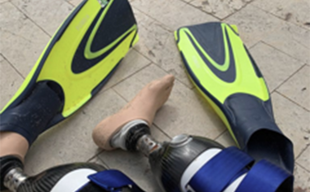Shaun Whiter prosthetic legs